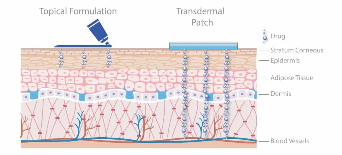 topical transdermal